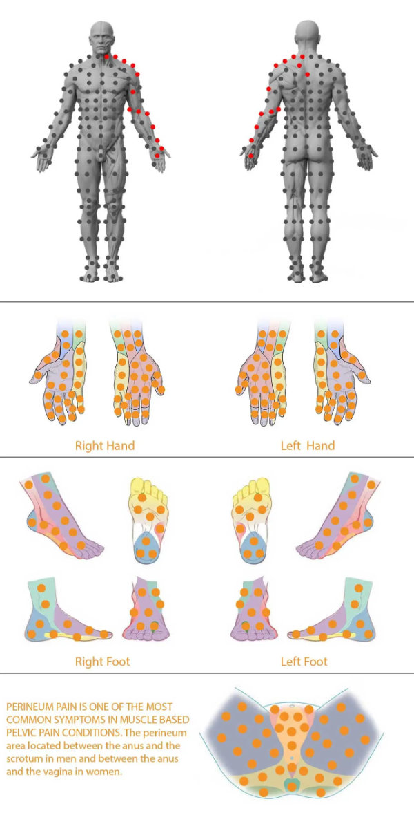 Pain locations in the body