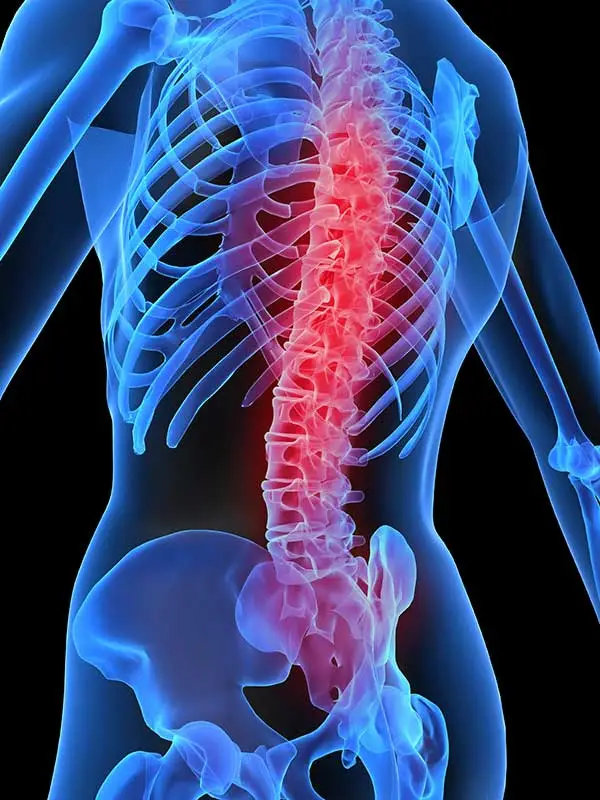 Back pain spine image