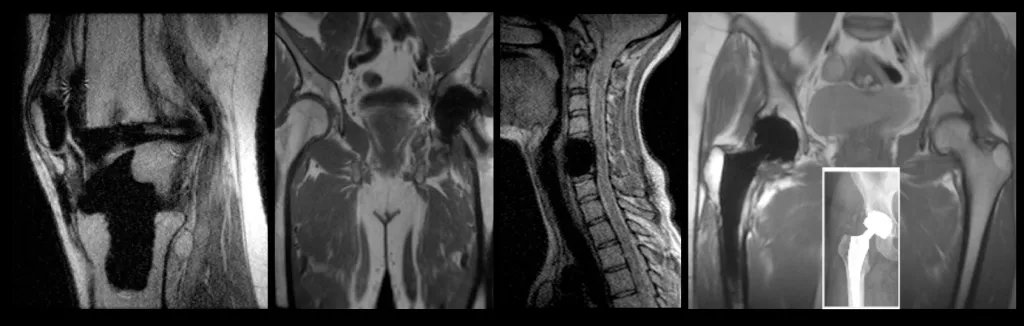 Magnetic Resonance Imaging