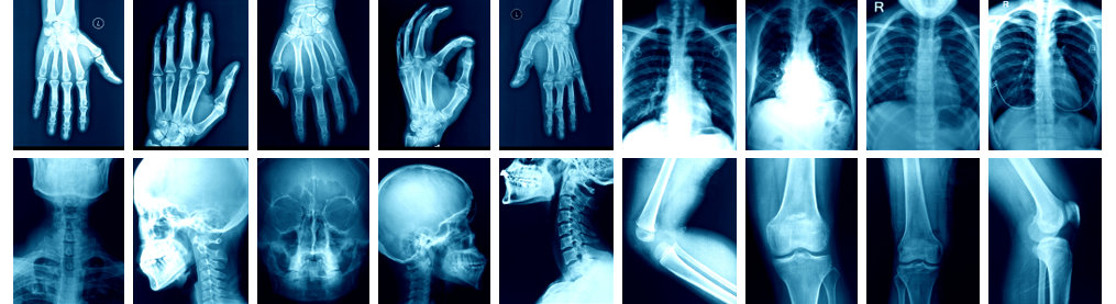 X-ray images